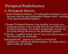 Image result for Radicular Cyst vs Periapical Abscess