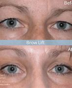 Image result for How to Fix Messed Up Eyebrows