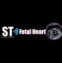 Image result for Fetal Heart Anatomy Ultrasound