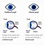 Image result for What Does Dilation Look Like