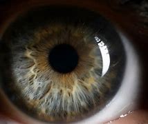 Image result for Alzheimer's may appear in eyes first
