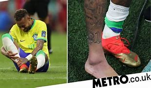 Image result for Neymar Ankle Injury