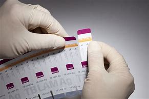 Image result for Pic of Urine Test