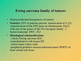 Image result for Ewing's Sarcoma