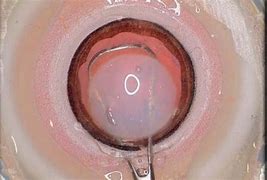 Image result for extracurrocular