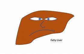 Image result for Funny Fatty Liver Meme