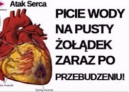 Image result for co_to_za_Żóraw