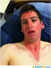 Image result for What to Do for Bad SunBurn