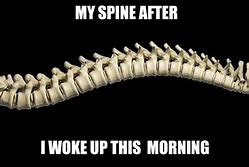 Image result for Spine Meme