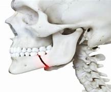 Image result for Jawbone Breaks