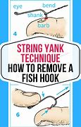 Image result for Fish Hook Removal with String