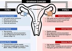 Image result for Ovarian Cancer Subtypes