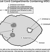 Image result for Umbilical Cord Healing Process