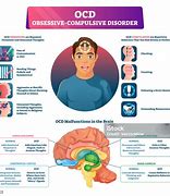 Image result for OCD Brain Diagram