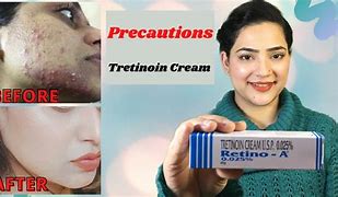 Image result for Tretinoin Cream 0.025 Before and After