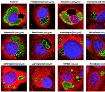 Image result for Chlamydia Trachomatis Shape and Arrangement