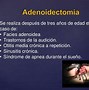 Image result for adenoices