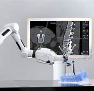 Image result for Robotic Spine Surgery