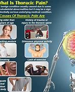 Image result for Thoracic Spine Pain Symptoms