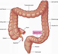 Image result for Diagram of Colon with CM