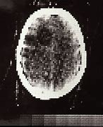 Image result for 1st Generation CT Scanner