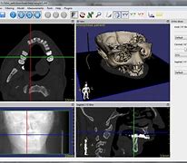Image result for DICOM 3D Viewer