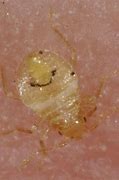 Image result for Baby Bed Bugs