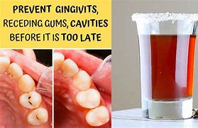 Image result for Best Mouthwash for Gum Disease
