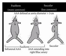 Image result for AAA Types