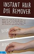 Image result for How to Get Hair Dye Off Skin