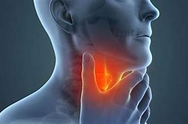 Image result for Crazy Difficult Head and Neck Cancer