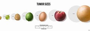 Image result for Tumor Size Chart Fruit