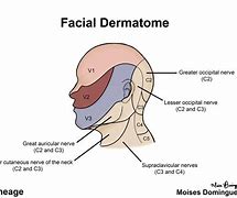 Image result for Cranial Dermatome Map