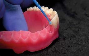 Image result for CAD/CAM Dentures