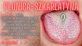 Image result for co_to_znaczy_Żółtaczka_zakaźna
