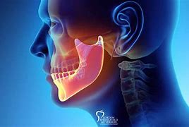 Image result for Healthy Jawbone