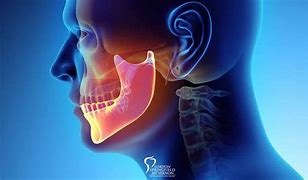 Image result for Healthy Jawbone