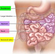 Image result for tapered ileum