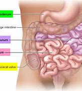 Image result for How Long Is Your Small Intestine