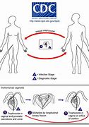 Image result for Incubation of Trichomoniasis
