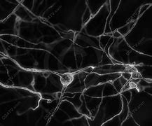 Image result for Brain Neurons Black