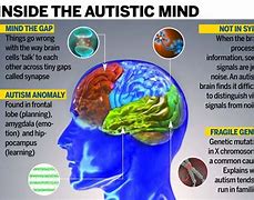 Image result for Autism Spectrum Disorder Brain