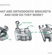 Image result for Bracket Attachments