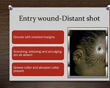 Image result for 7 62 vs 5 56 Exit Wounds