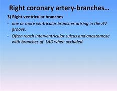 Image result for Subclavian Artery Branches