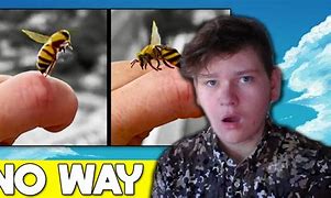 Image result for Bee Sting Reaction