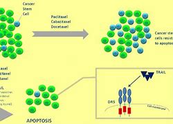 Image result for Tumor Density