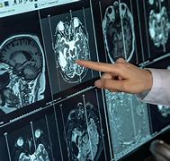 Image result for Diagnosis Images