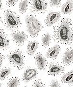 Image result for What Does Toxic Black Mold Look Like