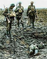 Image result for WW1 Casualties